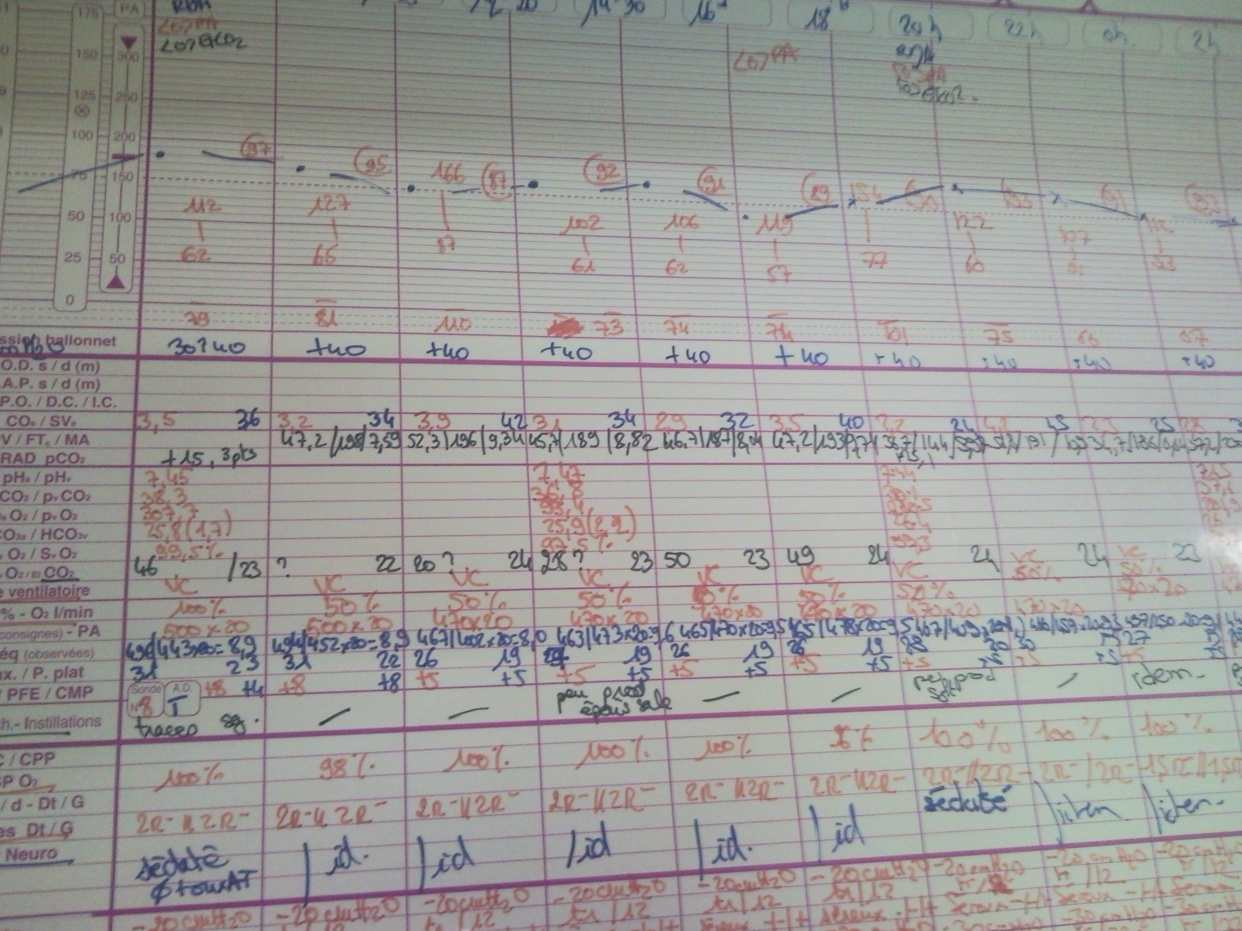 6.813/6.831 User Interface Design and Implementation > EZ-ICU GR1 > nurse whiteboard - parameters.jpg